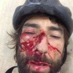 vittoriobrumotti_incidente